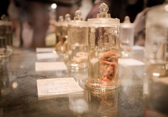 美国子宫切除试管婴儿机构，美国子宫切除试管婴儿机构有哪些？